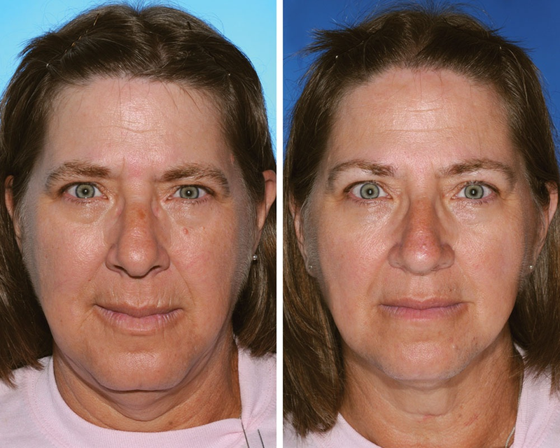 Illustration for article titled Guess which of these identical twins is the smoker